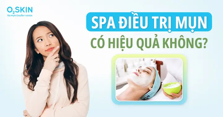 Da Bị Mụn Nên Đi Da Liễu Hay Đi Spa Sẽ Hiệu Quả Hơn? - Phòng Khám ... Da Bị Mụn Nên Đi Da Liễu Hay Đi Spa Sẽ Hiệu Quả Hơn? - Phòng Khám ...