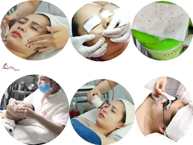 Có Nên Đi Lấy Nhân Mụn Tại Spa Không ?