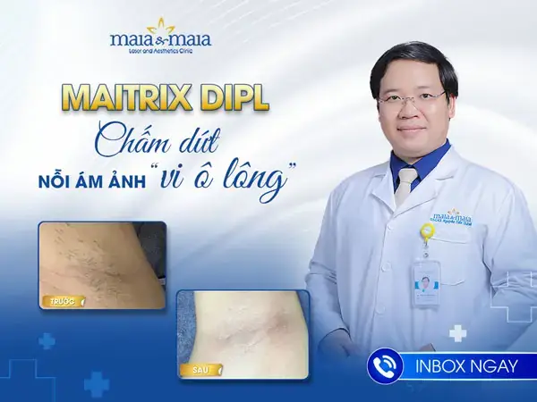 Giải Pháp Triệt Râu Vĩnh Viễn Không Cần Lo Lắng Khi Đi Máy Bay Giải Pháp Triệt Râu Vĩnh Viễn Không Cần Lo Lắng Khi Đi Máy Bay