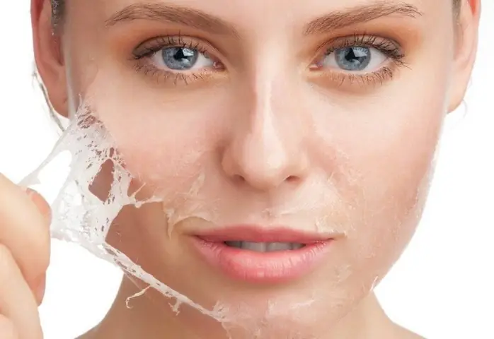 Lợi Ích Khi Peel Da Mặt Và Tác Dụng Phụ Cần Biết | Vinmec