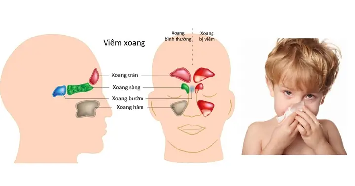 Giao Mùa Thu – Đông (tháng 10 – Tháng 11) Giao Mùa Thu – Đông (tháng 10 – Tháng 11)