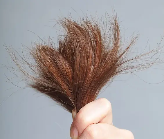 Tại Sao Tóc Của Bạn Bị Khô Xơ? | Vinmec
