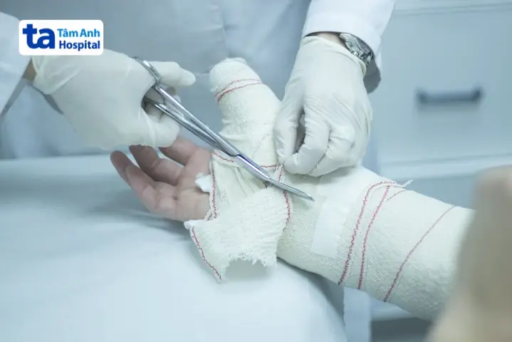 Dấu Hiệu Nhận Biết Xương Của Trẻ Bó Bột Đã Liền Và Cần Tháo