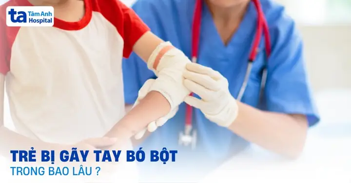 Trẻ Bị Gãy Tay Bó Bột Trong Bao Lâu? Khi Nào Gỡ Bỏ Được? Trẻ Bị Gãy Tay Bó Bột Trong Bao Lâu? Khi Nào Gỡ Bỏ Được?