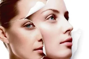 Lã M Tráº» Hã³a Da Máº·t Báº±ng Cã´ng Nghá» Tráº» Hã³a Má»i