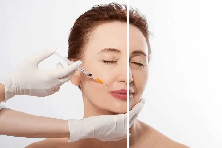 Quy Trình Trẻ Hoá Da Mặt Bằng Tế Bào Gốc