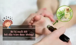 Bé Bị Muỗi Đốt Bôi Dầu Tràm Được Không? Lưu Ý Khi Dùng – Natonic ...