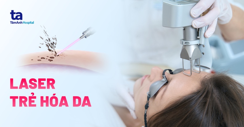 trẻ hóa da bằng laser có tốt không - Hình 3